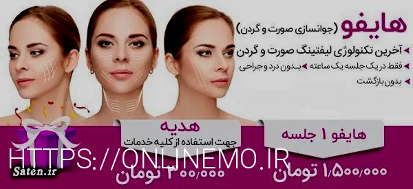 انواع هایفو